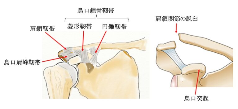 病態・症状の図解