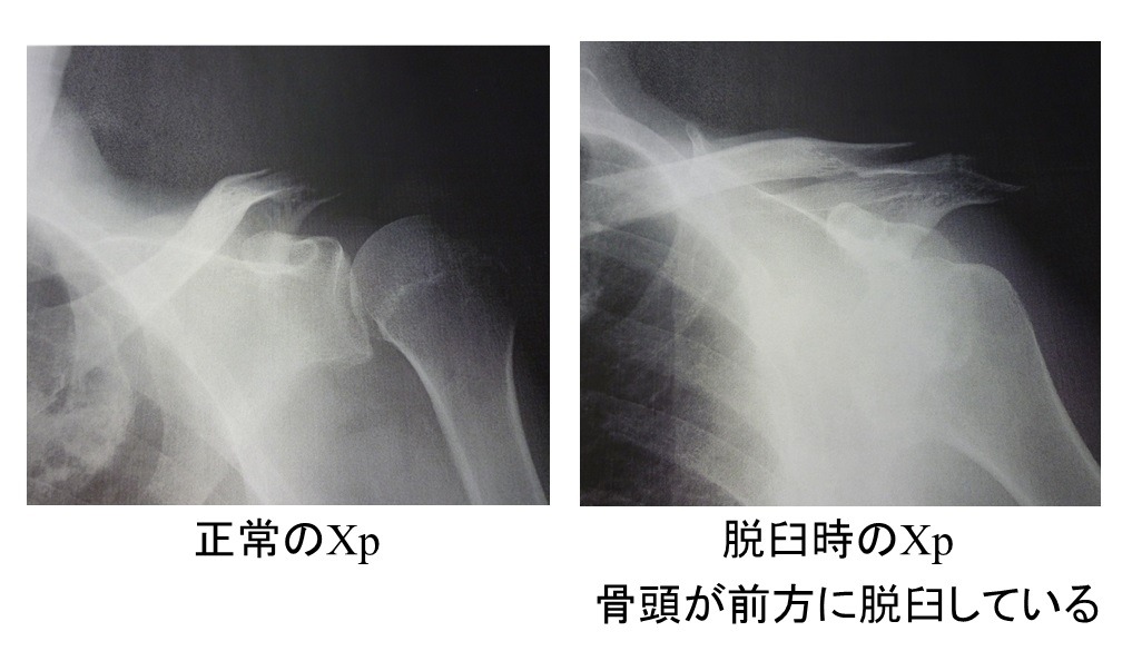 レントゲン画像