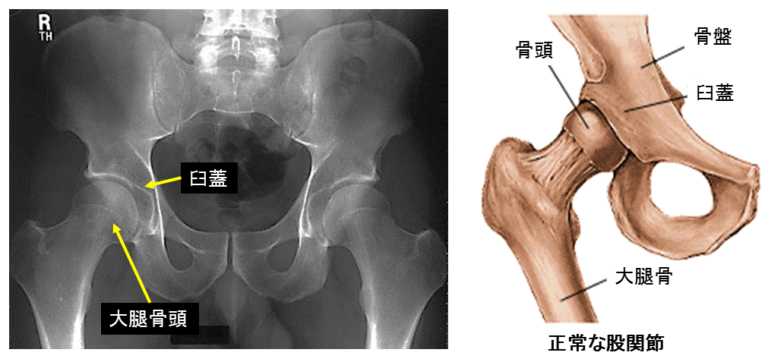 股関節のレントゲンと構造