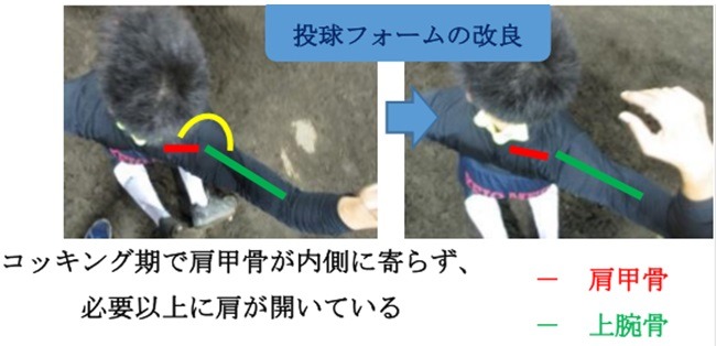 投球フォームの改良