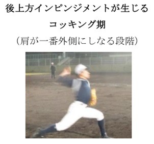 投球フォームの例