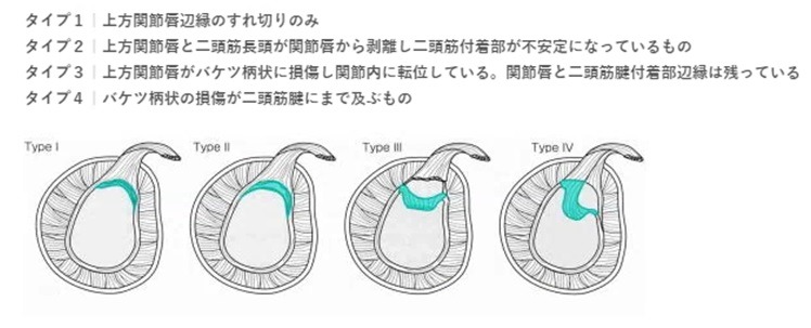 Snyder分類の図