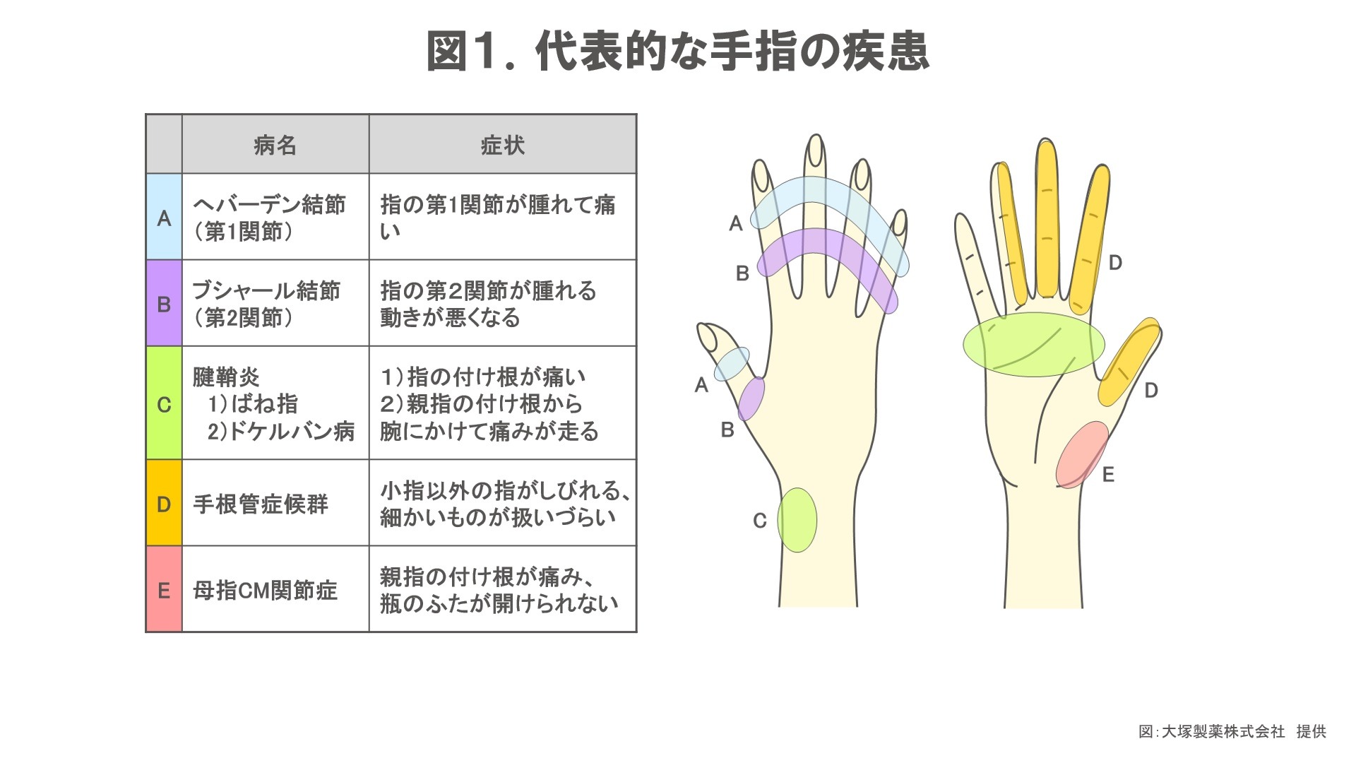 手指疾患の図解