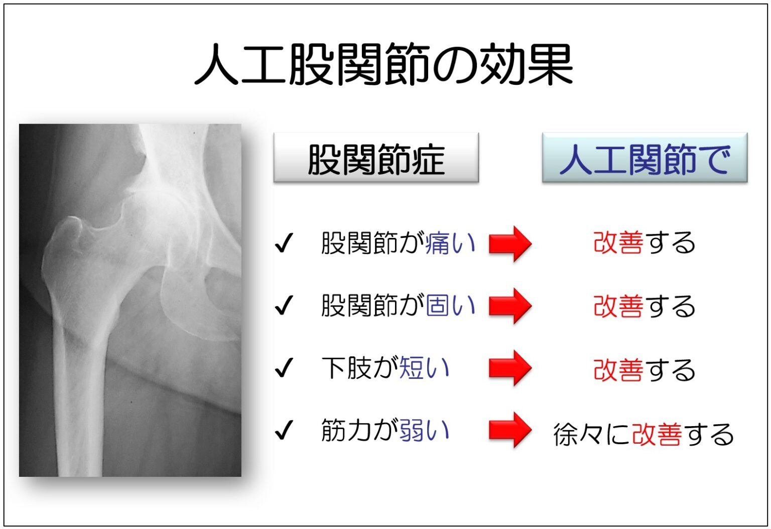術後の回復イメージ