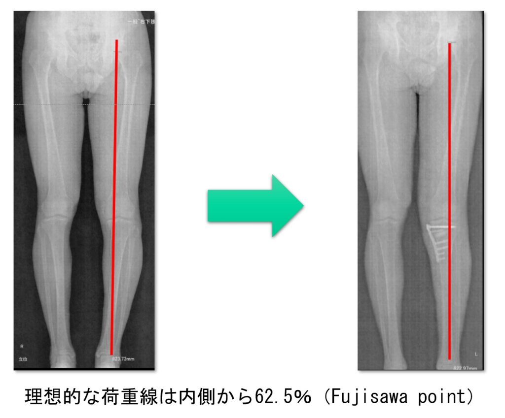術前後の外観比較画像