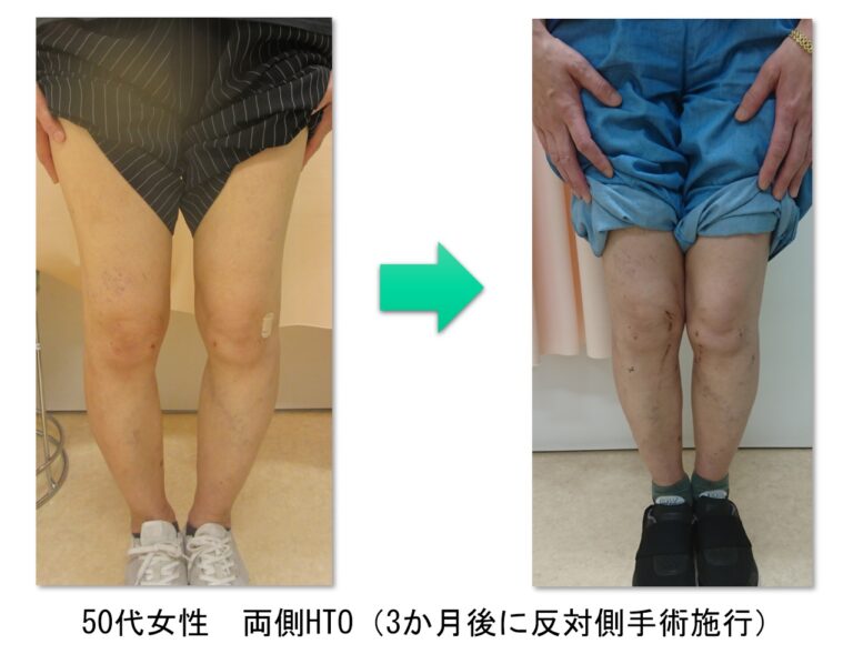 術前後の外観比較画像