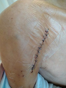 リハビリの様子