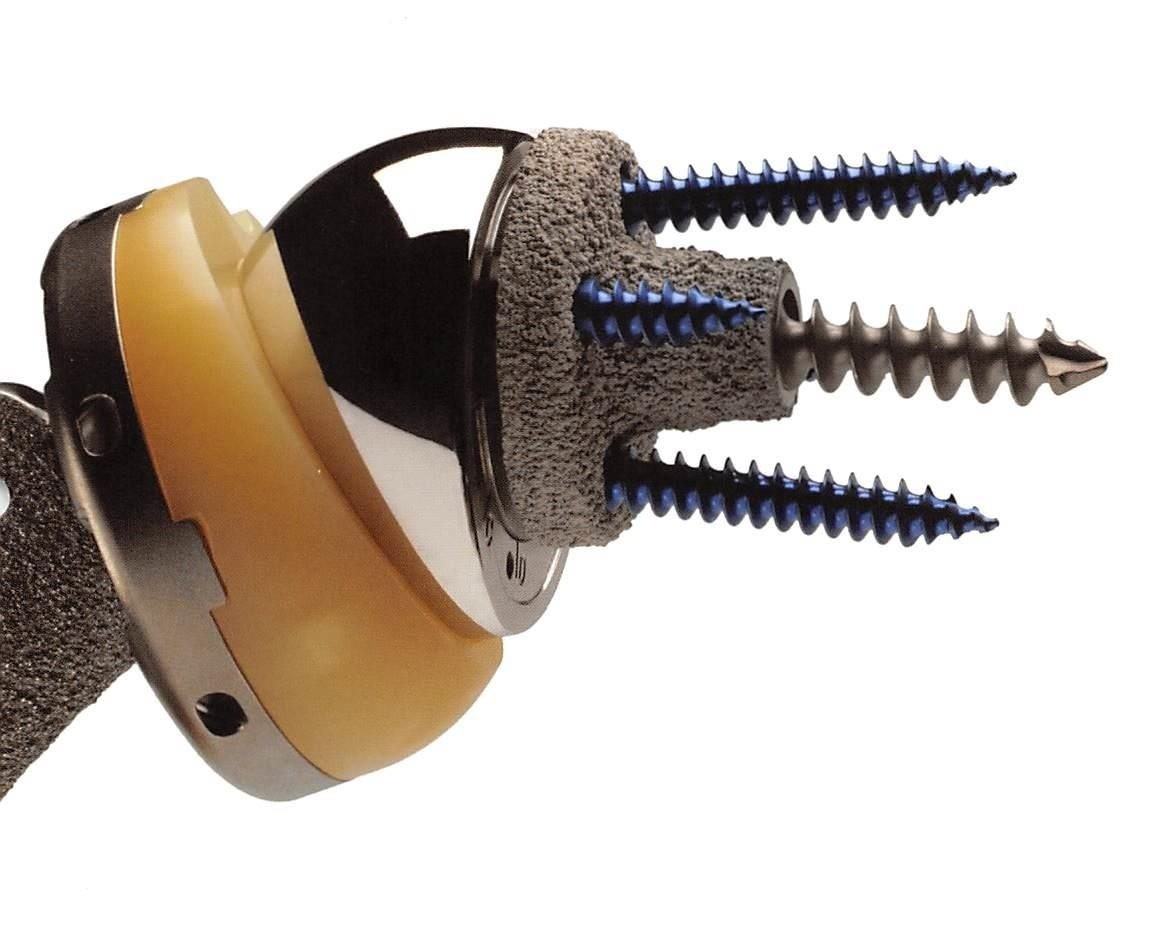 リバース人工肩関節